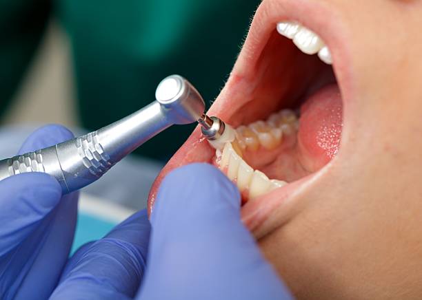 Trusted Lofall, WA  Dental Services Experts